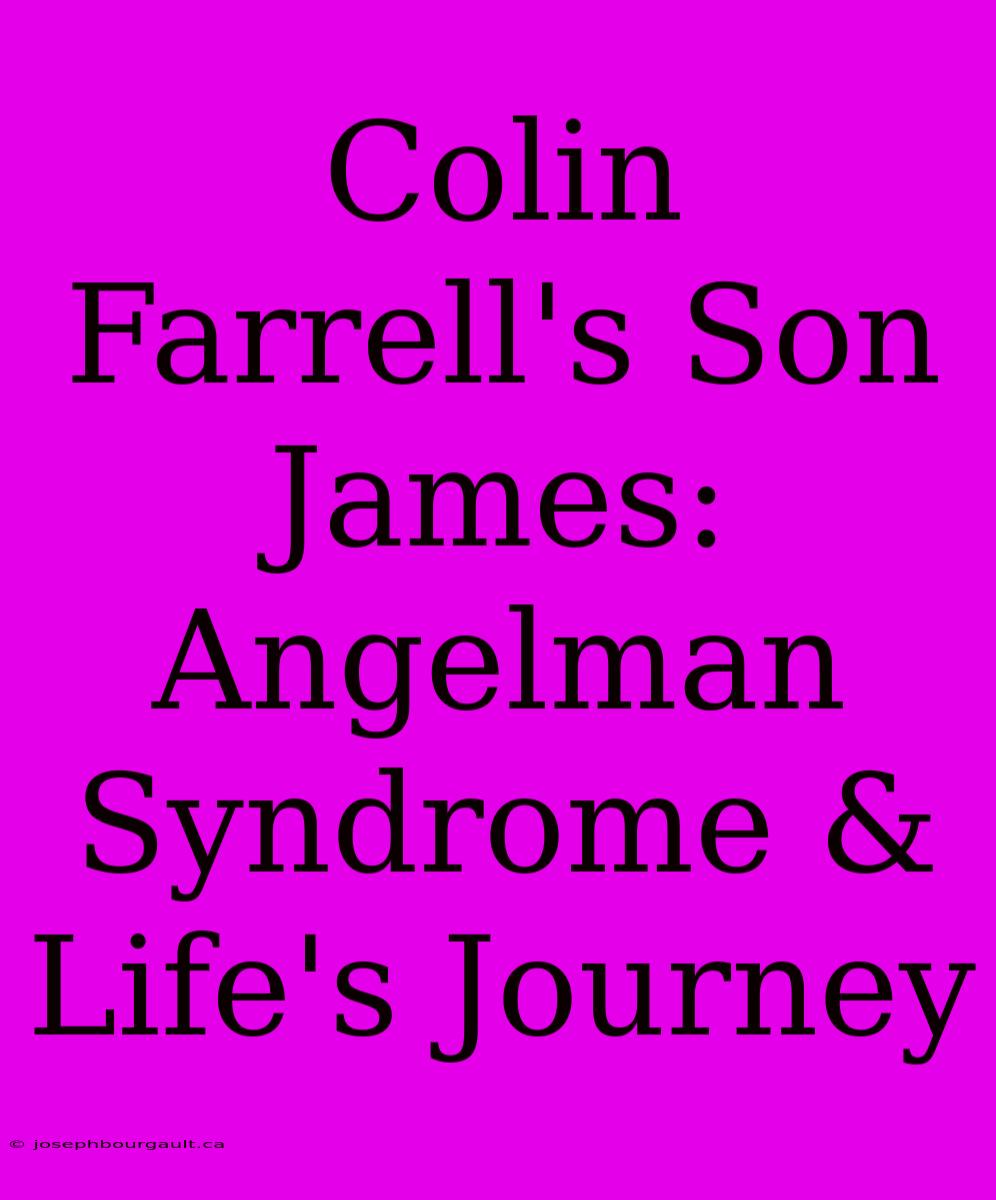 Colin Farrell's Son James: Angelman Syndrome & Life's Journey