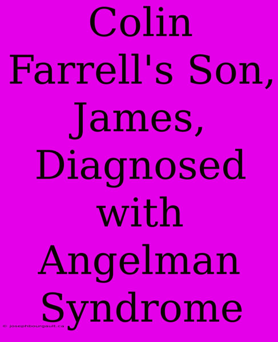 Colin Farrell's Son, James, Diagnosed With Angelman Syndrome