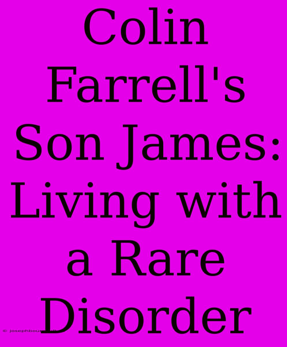 Colin Farrell's Son James: Living With A Rare Disorder